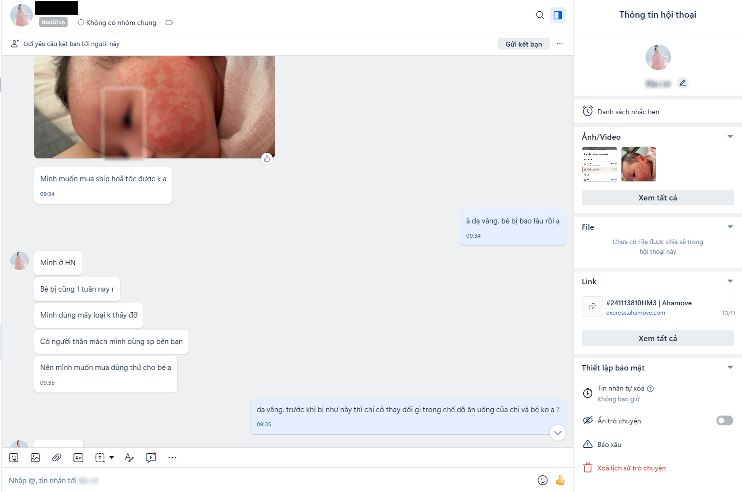 chàm sữa trẻ sơ sinh